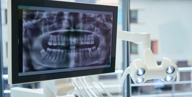 digital x-ray