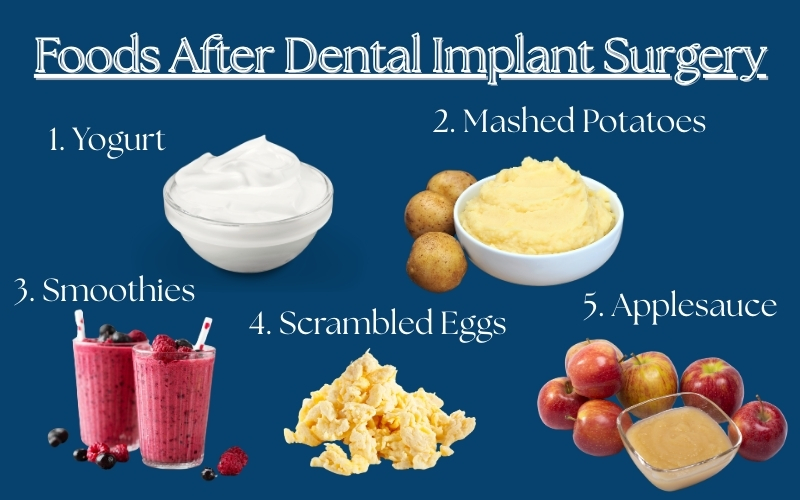 Foods After Dental Implant Surgery