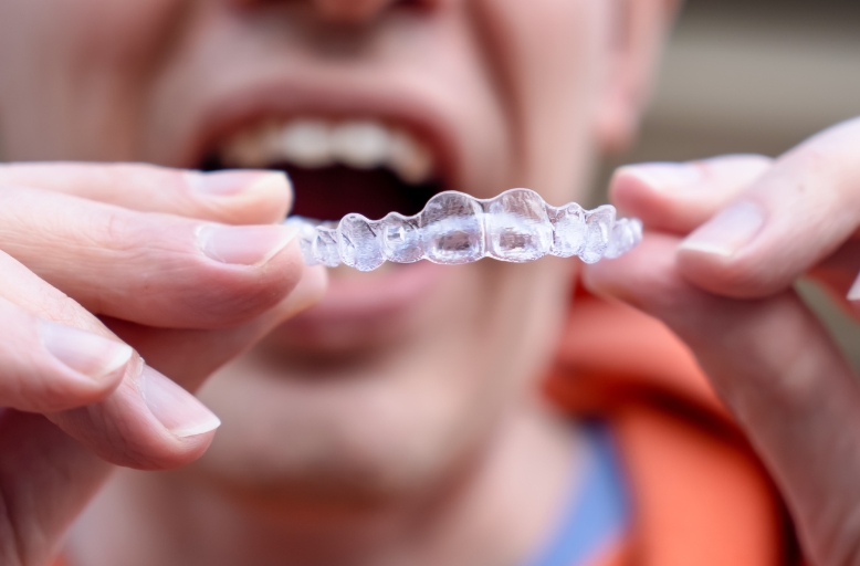 Modern orthodontic treatment with removable, comfortable clear aligners available at dental clinics across North Austin and Cedar Park.