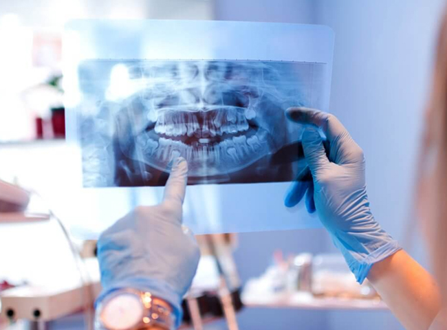 Dentist reviewing digital dental X-rays to evaluate teeth and jaw health in Austin, TX