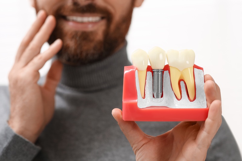 Patient holding dental implant model for missing teeth replacement in Austin, TX